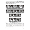 同仁眼科影像学 鲜军舫 王新艳 主编 适合于影像科医师 眼科医师 放射治疗科医师及相关人员参考 9787117379977人民卫生出版社 商品缩略图4