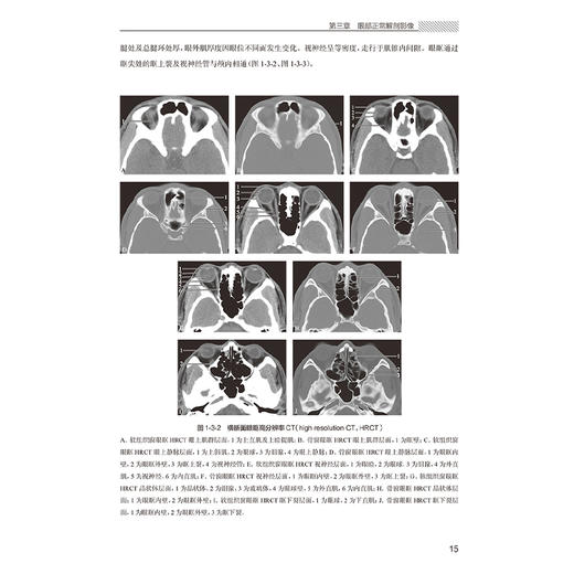 同仁眼科影像学 鲜军舫 王新艳 主编 适合于影像科医师 眼科医师 放射治疗科医师及相关人员参考 9787117379977人民卫生出版社 商品图4