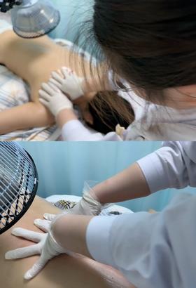 中医背部经络疏通 （仅到兴华社卫使用）