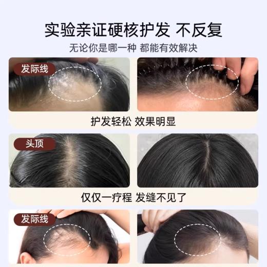 【品牌直发】沈梦辰代言❗国货洗护产品天猫销量TOP❗️EHD防脱防断固洗发水护理组合❗️爆款💦洗出飘逸感！ 商品图6