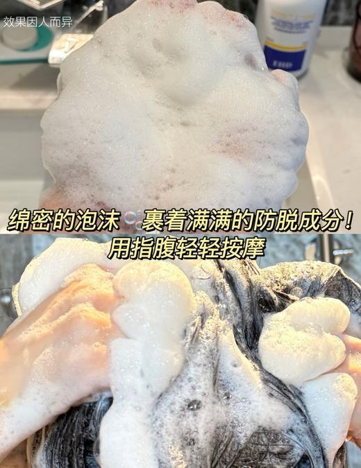 【品牌直发】沈梦辰代言❗国货洗护产品天猫销量TOP❗️EHD防脱防断固洗发水护理组合❗️爆款💦洗出飘逸感！ 商品图14
