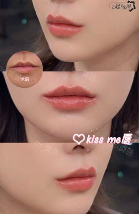 【黄源】主任-嘟嘟唇案例