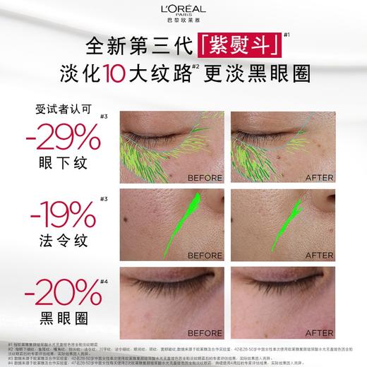 【春季焕新】【全球购】LOREAL欧莱雅第三代欧莱雅眼霜30g 提亮眼周 -X 商品图2