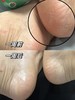 ✨去脚👣气快❗准❗狠❗一抹终结脚丫“臭痒烂”👣 『香巷🇭🇰宝芝林-🐺D草本清脚👣气膏』✅ 去臭+止庠+修復！三管齐下❗全家都适用👍 商品缩略图3