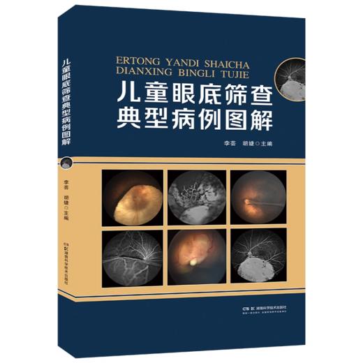 儿童眼底筛查典型病例图解 商品图0