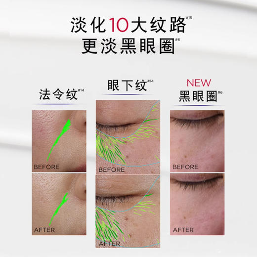 【春季焕新】【全球购】LOREAL欧莱雅第三代欧莱雅眼霜30g 提亮眼周 -X 商品图7