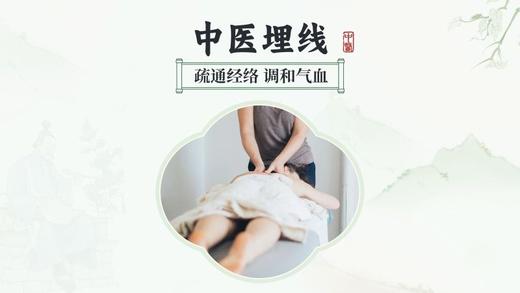 中医穴位埋线（仅到兴华社卫使用） 商品图0
