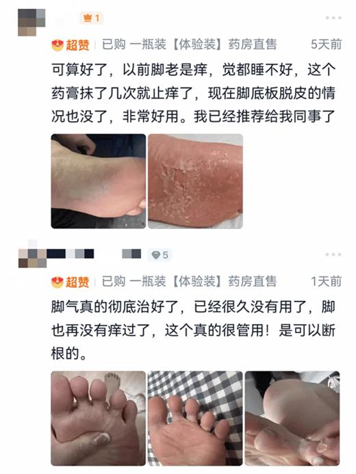 ✨去脚👣气快❗准❗狠❗一抹终结脚丫“臭痒烂”👣 『香巷🇭🇰宝芝林-🐺D草本清脚👣气膏』✅ 去臭+止庠+修復！三管齐下❗全家都适用👍 商品图4