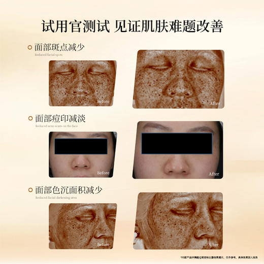 【品牌直发 赠同款小样7ml*5】安科丽光透曜白精华液40ml 商品图1