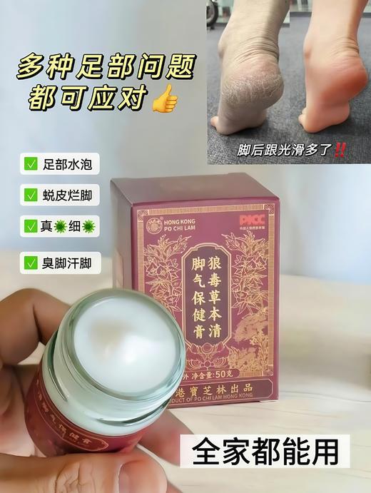 ✨去脚👣气快❗准❗狠❗一抹终结脚丫“臭痒烂”👣 『香巷🇭🇰宝芝林-🐺D草本清脚👣气膏』✅ 去臭+止庠+修復！三管齐下❗全家都适用👍 商品图1