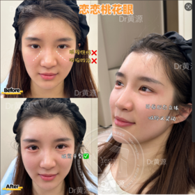 【黄源】主任-恋恋桃花眼打造 