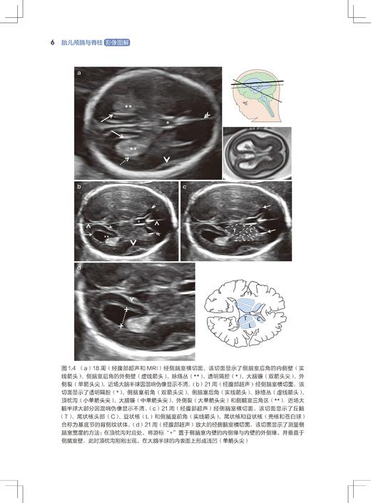 胎儿颅脑与脊柱影像图解（新媒体定制版） 商品图3