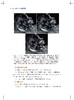 胎儿颅脑与脊柱影像图解（新媒体定制版） 商品缩略图2