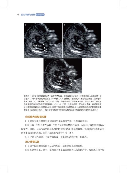 胎儿颅脑与脊柱影像图解（新媒体定制版） 商品图2