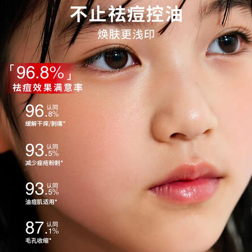 朵望祛痘凝胶儿童青少年护肤面霜 商品图2