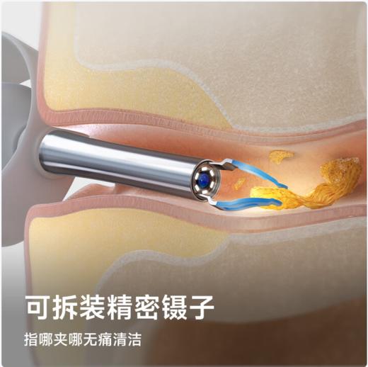 bebird 蜂鸟 智能可视洁耳仪 商品图8