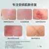 【医用百搭精华】专注受损肌肤修复~预防疤痕~百搭胶原精华，月抛色修防疤！ 全家人的护肤神器 商品缩略图2