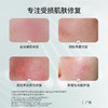 【求美者医用面膜】 皮肤屏障 色素沉着 术后损伤  晒伤/创面护理~医美伴侣，退红舒敏，免洗~ 商品缩略图2