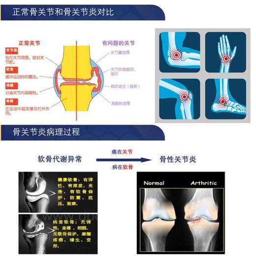 德国🇩🇪进口MIKOY软骨素氨糖乳钙片 商品图8