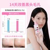 ilso一苏黑头导出精华液套装50ml（HelloKitty款） 去黑头 商品缩略图2