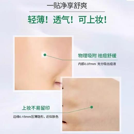 VT老虎痘痘贴66枚 商品图1