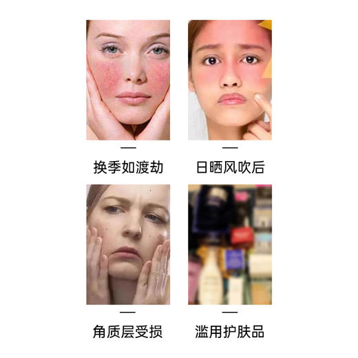 雅琪朵：甘菊面霜50ml  甘菊修复霜舒缓敏感晒后修复改善脆弱泛红 面霜 商品图1