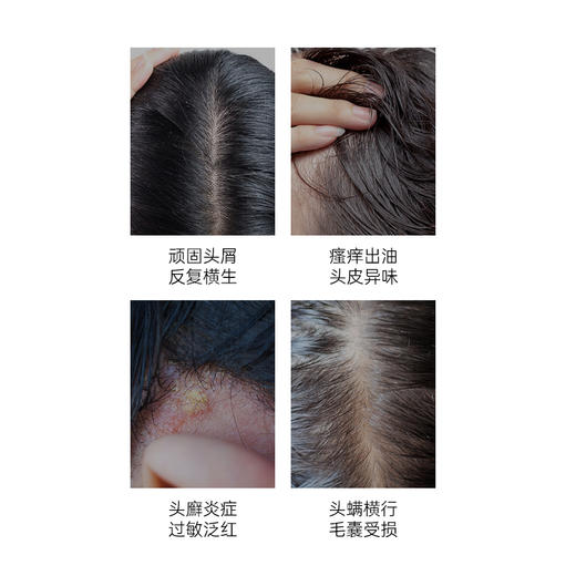 雅琪朵：头皮调理洗发精 100ml   去屑控油洗发水 商品图3