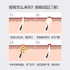 雅琪朵：牛蒡面霜50ml 祛痘膏 男女祛痘粉刺痘疤淡化修复纯有机 商品缩略图2