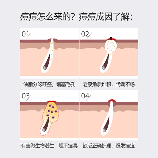 雅琪朵：牛蒡面霜50ml 祛痘膏 男女祛痘粉刺痘疤淡化修复纯有机 商品图2