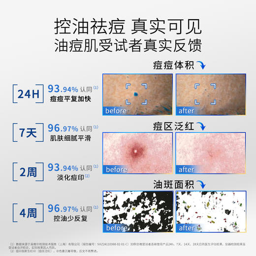 敷尔佳清痘净肤次抛精华 1.3mL*5支/盒 商品图2
