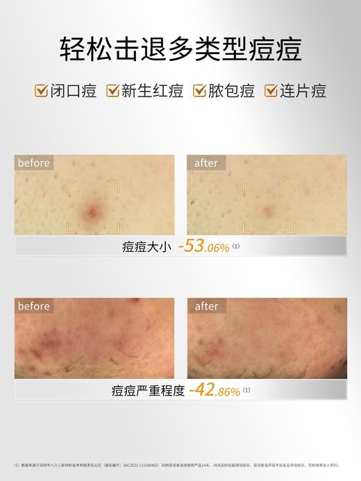 敷尔佳 乳糖酸控油敛肤面膜 25g*5贴/盒 商品图1