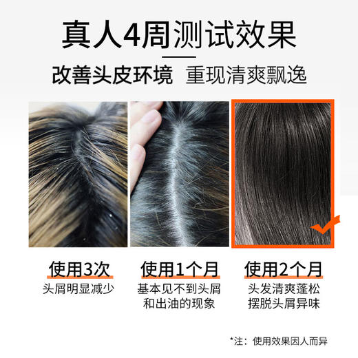 【分仓直发包邮】LK氨基酸去屑止痒柔顺洗发水500g 商品图2