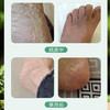 【陈沅堂抑菌液赠真菌快克】真菌困扰救星！ 专攻脚气脱皮瘙痒 草本温和根治 180ml/瓶（2.7-2.22停发） 商品缩略图3