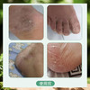 【陈沅堂抑菌液赠真菌快克】真菌困扰救星！ 专攻脚气脱皮瘙痒 草本温和根治 180ml/瓶（2.7-2.22停发） 商品缩略图4