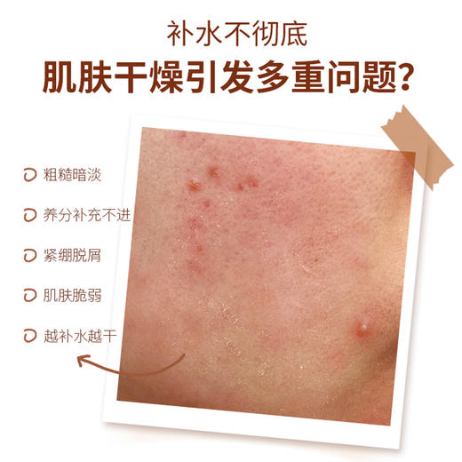 【BIOHYALUX/润百颜】第二代润百颜香槟水 300ml/瓶（2.11-2.24停发） 商品图1