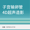 【适用北三环院区】子宫输卵管4D超声造影（不含麻醉） 商品缩略图0