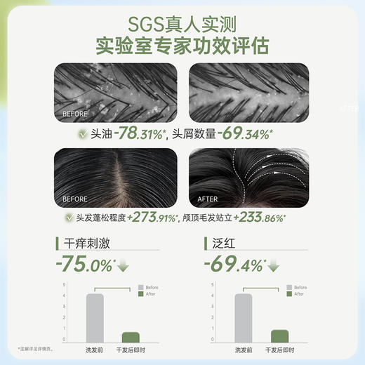 袋鼠妈妈 青少年去屑控油洗发水(清新白茶)380ml 长效控油  净屑舒痒  48小时发货 商品图2