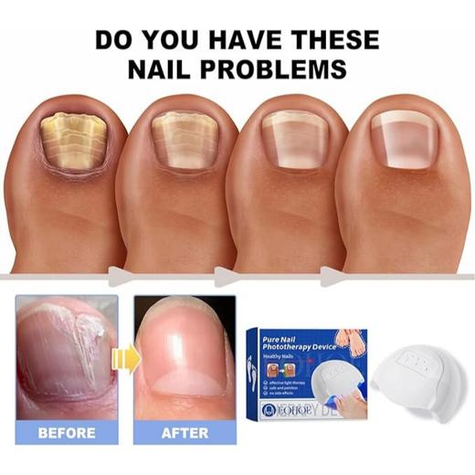 紫外线指甲护理仪 商品图2