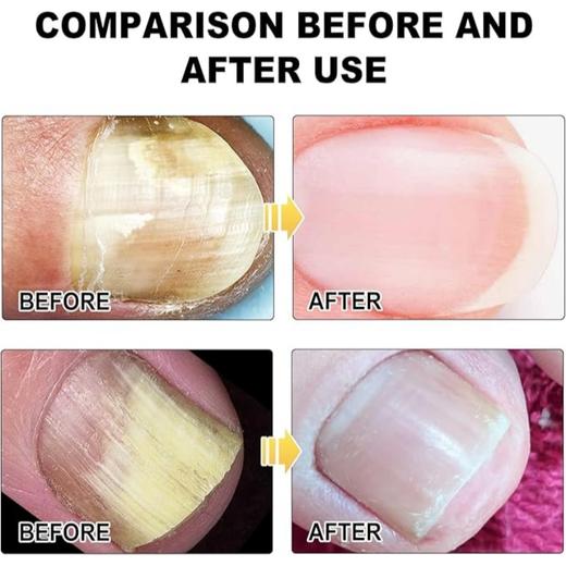 紫外线指甲护理仪 商品图3