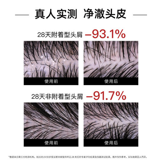 【年货价】发玛21 蓬松去屑洗发水 600ml 商品图2