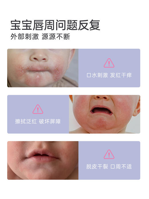 芮洣舒婴儿唇周舒缓膏20g 商品图1