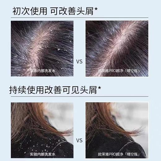 欧莱雅头皮去屑净化洗发水500ml/瓶 商品图3