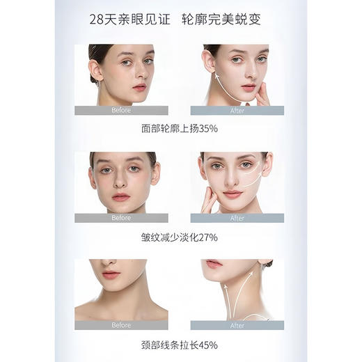 德国原产 LMK瘦脸美容仪 提拉紧致脸部纹塑形 按摩滚轮家用美容 商品图4