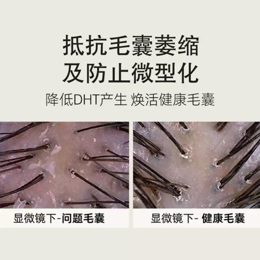 海瑟薇生姜健发护发素（芯韧修护）460ml 商品图4