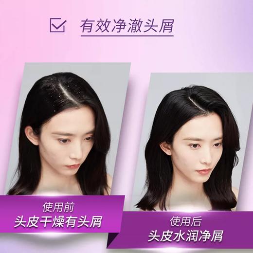 450g清扬去屑洗发露多效水润 商品图1