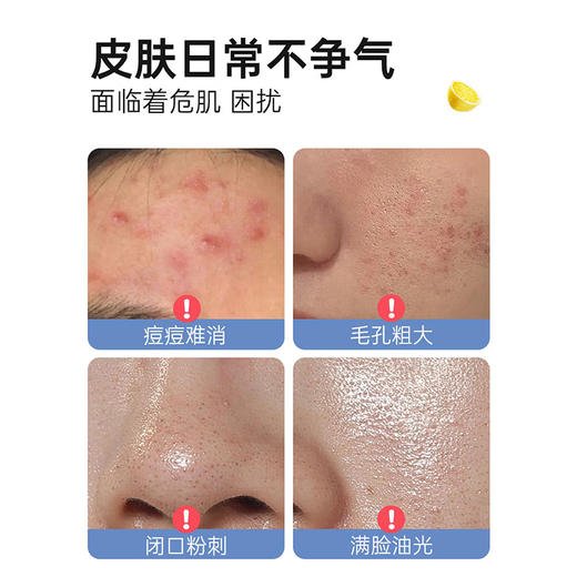 【京东施颜适洁面榜热卖/买家热评20W+】施颜适水杨酸祛痘棉片 1%/2%水杨酸 男女刷酸去黑头粉刺 祛痘痘闭口控油洁面 净含量55片（125g） 商品图4