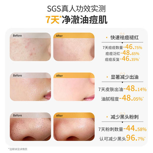 【2只装】袋鼠妈妈青少年雪泥洁面乳 100g*2支  安肌祛痘/安肌清透 商品图5