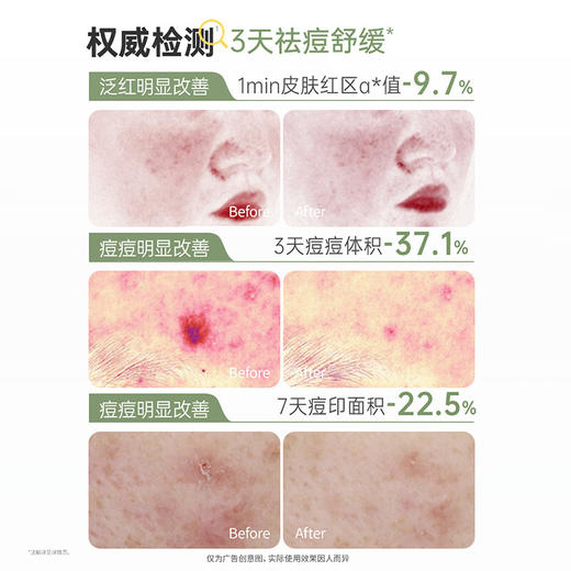 严选 | 袋鼠妈妈祛痘修护棉片100片【赠祛痘洁面15g】 商品图4