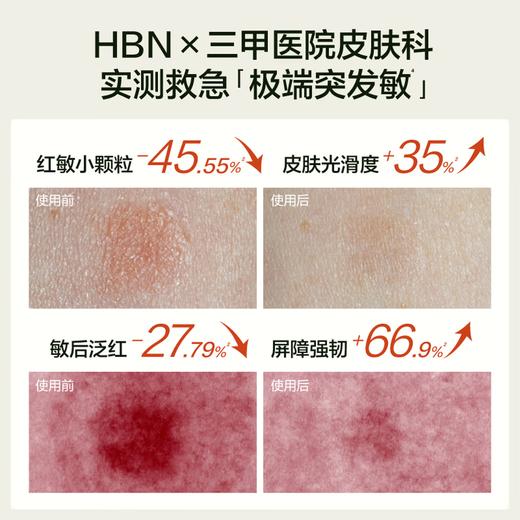 HBN泛醇修护特润霜（干皮/修护） 商品图3