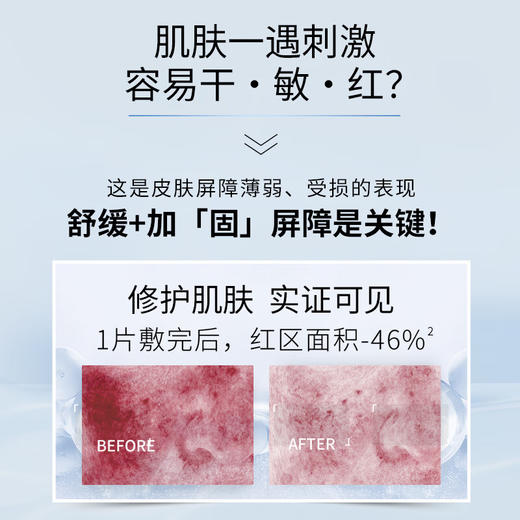 AHC臻致专研HYDRA B5玻尿酸补水面膜(5*27ml) 商品图4